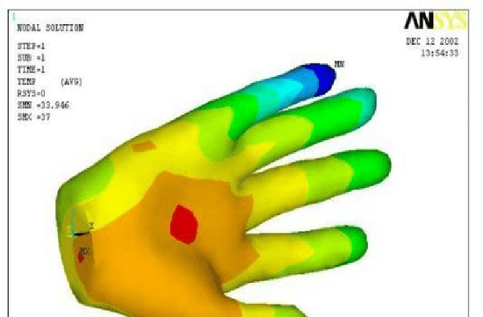 Thermal imaging of human palm showing temperature distribution, related to blood flow and autonomic nervous system activity