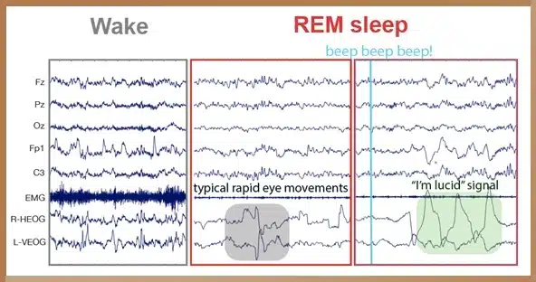 EEG readings showing brain activity during wakefulness and REM sleep, with annotations for rapid eye movements and a lucid dreaming signal.